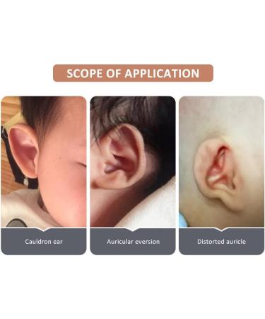 Baby Auricle Valgus Correction Patch - Protruding Ear Sticker for Toddlers | Baby Ear Aesthetic Corrector - Buy Online on GoSupps.com