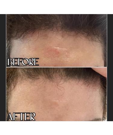 Pirene Organic Face Serum - Redness Relief Moisturizer for Dry Sensitive Skin Rosacea Eczema & Dermatitis | 1.0 fl oz Exfoliating Lotion - International Shipping Available - Buy Online on GoSupps.com