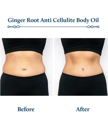 Blue Nectar Ayurvedic Anti Cellulite & Slimming Oil 100ml | Natural Body Oil for Smooth Skin - Buy Online on GoSupps.com