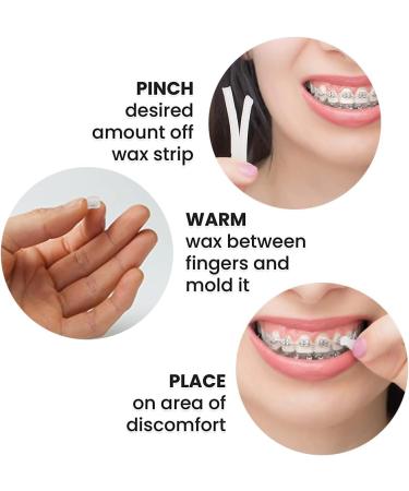 Braces Wax - Orthodontic Wax for Pain Relief | 25 Strips | 5-Pack Dental Wax for Braces - Buy Online on GoSupps.com