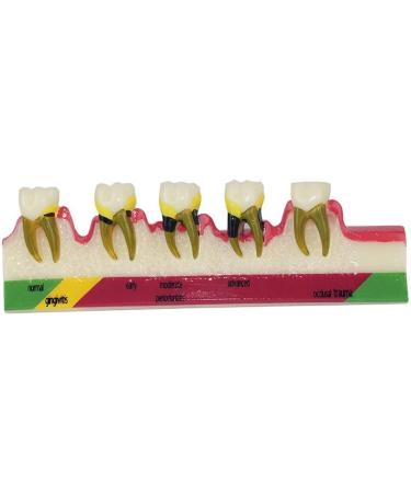 Anatomical Dental Lab Equipment - Oral Hygiene Model for Periodontal Disease & Tooth Classification - International Shipping - Buy Online on GoSupps.com