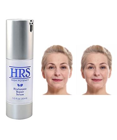 Hyaluronic Repair Concentrate - High Potency Serum by BioLogic Solutions (1 fl oz) | International Shipping Available - Buy Online on GoSupps.com