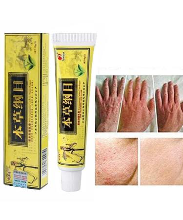 Omaky 2pcs Chinese Herbal Eczema Psoriasis Creams Dermatitis and Eczema Pruritus Psoriasis Ointment (New Packaging)