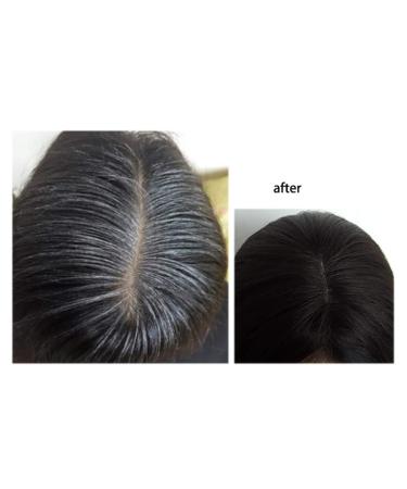 Human Hair Clip-In Hairpiece 28cm Mono Topper for Thinning Hair - Side Parting Solution - Buy Online on GoSupps.com