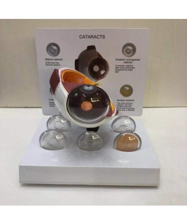 Mod le Anatomies Malade Human Eye Pin Yey Blessure Eye Corn e Cataparakt Eye Mod le Education pour l' cole - Buy Online on GoSupps.com