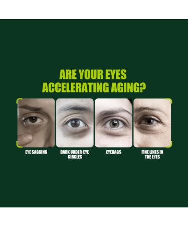 AICHUN BEAUTY Licorice Root Eye Cream Anti-Wrinkle Firming Dark Circles 25g / 0.85 fl.oz - Buy Online on GoSupps.com