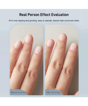 Automatic Nail Clipper White/Black Portable Electric Fingernail Clippers with Light Safe Electric Nail Cutter and File 2 in 1 Design for Adults Kids Seniors#White#Blue - Buy Online on GoSupps.com