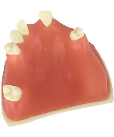 Samnuerly Education Model Toy - Upper Jaw Teeth Model for Sinus Lift & Implant Restoration (40mm) | Premium Dental Educational Tool - Buy Online on GoSupps.com
