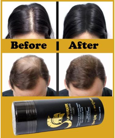 Hair Building Fibers + Hair Growth Oil with 5% Minoxidil Biotin Collagen - Thinning & Hair Loss Treatment - Medium Brown - Buy Online on GoSupps.com