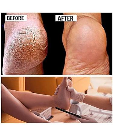 Pedicure Foot File Foot Scraper Foot Pedicure Tool Foot Dead Skin Remover for Pedicure - Buy Online on GoSupps.com