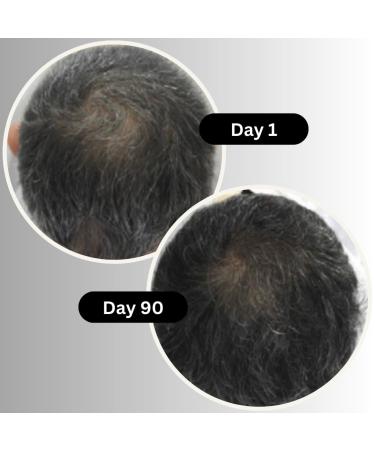 Multi-Peptide Grey Hair Treatment Serum | Advanced Anti-Grey & Hair Growth Formula with Caffeine Vitamin B5 & Hyaluronic Acid - 60 ml - Buy Online on GoSupps.com