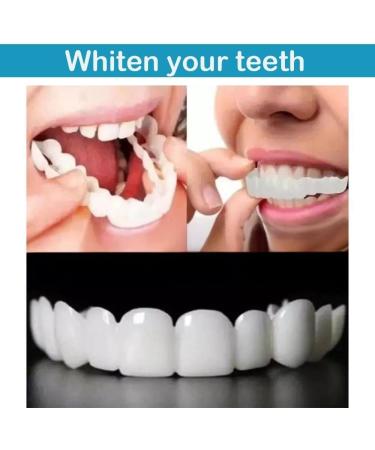 Denture Veneers Dental Tooth False Teeth Snap On Top and Bottom for Men and Women Fix Confident Smile - Buy Online on GoSupps.com