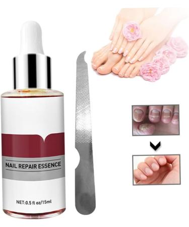 1PC Nail Treatment Nail Renewal Solution Toenails & Fingernails Nail Repairs Essential Oil Protects Toenail Fungus Treatment From Discoloration Brittle And Cracked Nail(12ML) - Buy Online on GoSupps.com