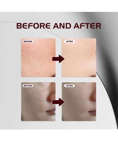 2PCS Facial Brightening Essence Essential Oil Is Suitable for Dry Skin to Maintain Skin Oil Balance and Moisturize - Buy Online on GoSupps.com