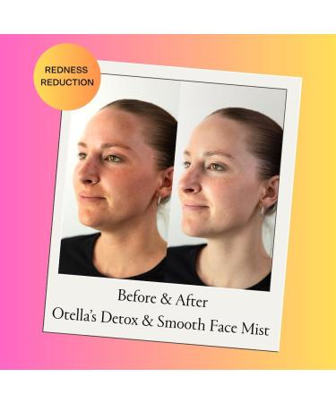 Detox & Soothe Face Mist with Hypochlorous Acid | Reduces Redness & Breakouts | pH Balance & Skin Cleansing for Active Lifestyles | TSA Approved 2.7 oz | Clean Ingredients - Buy Online on GoSupps.com