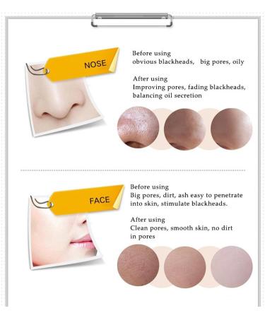 Deep Cleansing Blackhead Black Mud Mask - Purifying Peel for Acne & Pimples Removal | International Shipping Available - Buy Online on GoSupps.com