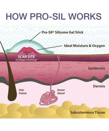 Pro-SIL Silicone Scar Treatment Stick 4.25g - FDA Cleared & Clinically Proven - Made in USA - Buy Online on GoSupps.com