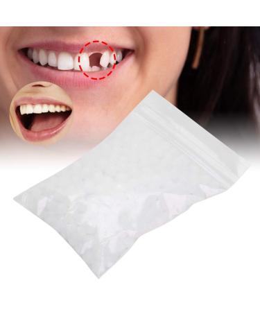 Temporary Tooth Repair Beads - 10g Filling Material for Missing/Broken Teeth - Replacement Kit - Buy Online on GoSupps.com