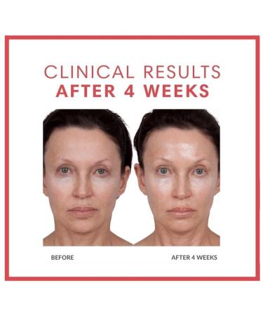 Consult Beaute Volumagen - Collagen Anti-Aging Serum for the Face - Hyaluronic Acid - Skin Nourishing & Plumping - Hydrates and Temporarily Fills for Smoother Bouncy Skin - 2 Oz. Duo (2 Piece Set) - Buy Online on GoSupps.com