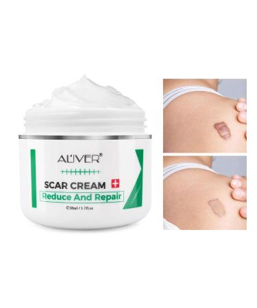 Scar Removal Cream for Old Scars Stretch Mark Relief and Burns Natural Skin Repair Effective in Fading Acne Scars Acne Spots Treatment.