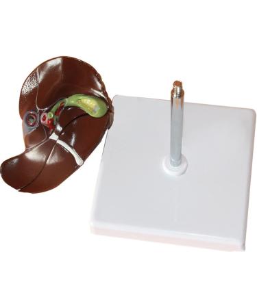 Liver Anatomy Model Human Liver Disease Model Liver Fat/Cirrhosis/Pathological Hepatobiliary Disease Model Medical Education and Training Auxiliary Human Organ Anatomical Model - Buy Online on GoSupps.com