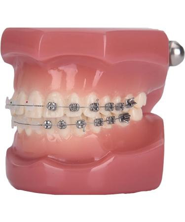 Dytah 1:1 Orthodontic Treatment Teeth Model - Patient Communication & Teaching Tool with Metal & Ceramic Brackets for Adults - Buy Online on GoSupps.com