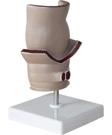 Medical Science Rectum Fissure Lesion Model 5X Human Pathology Model Hemorrhoid Anal Fistula Medical Organ Model - Buy Online on GoSupps.com