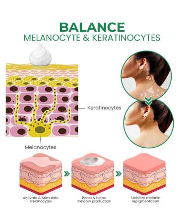 VitiligoFix Revitalize Elixir: Psoriasis Relief Cream & Moisturizer for Skin, Natural White Spot Remover (2Pcs) - Buy Online on GoSupps.com