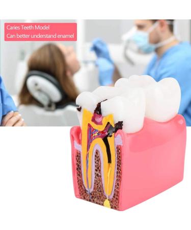 High-Quality Dental Prosthesis Model for Oral Care | International Shipping Available - Buy Online on GoSupps.com