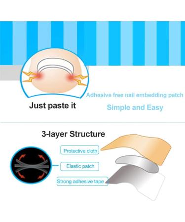 Ingrown Toenail Correction Patch Ingrown Correction Sticker 46 Pieces Ingrown Toenail Correction Patch Care Ingrown Nail Patch for Men Women - Buy Online on GoSupps.com