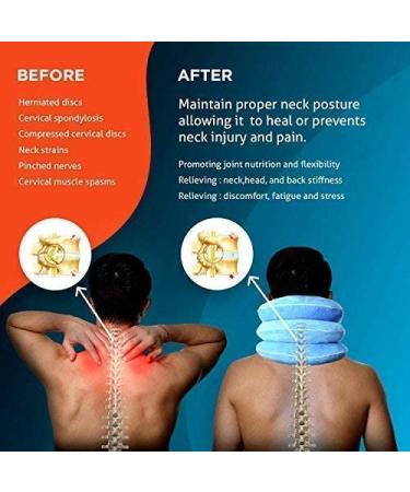 NeckFix Cervical Neck Traction Device for Instant Pain Relief - Pinched Nerve Stretcher + Bonus | 12-17 inch - Buy Online on GoSupps.com