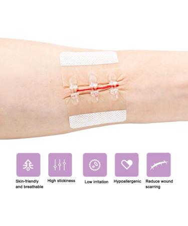Emergency Wound Closure Strips - Butterfly Bandages for First Aid | Adhesive Sutures for Zipper Laceration Repair (S) - 1 Piece 2.76x1.97 - Buy Online on GoSupps.com
