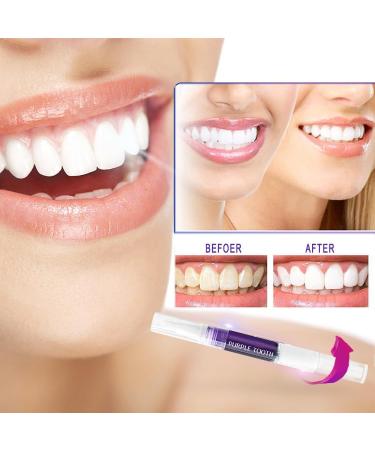 Tooth Whitening Pen Set - 3 Fast & Effective Bleaching Applications Remove Stains & Lighten Teeth - Purple & Blue Options Available - Buy Online on GoSupps.com