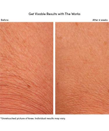 Summer Skin Bundle: Menopause Support Skincare Lotion + Biotin Supplements - Womaness The Works - 2 Products - Buy Online on GoSupps.com