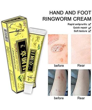 Natural Herbal Cream for Itching Allergy, Dry Skin Relief - Eczema Treatment - Buy Online on GoSupps.com