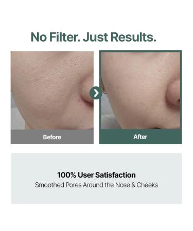 CELORABY Potension Pore Tightening Boost Serum - Advanced Korean Skincare Pore Minimizer with Exosome Technology Targets Excess Sebum & Impurities (1.01 fl.oz) - Buy Online on GoSupps.com