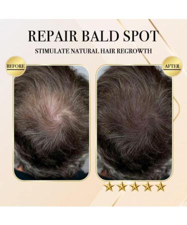 Ginger Hair Regrowth Shampoo Bar (2PCS) - Stimulate Hair Growth Naturally - Buy Online on GoSupps.com