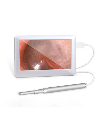 Feilx Ear Wax Removal Tool Ear Cleaner with Camera Endoscope Ear Pick 4.3 Inches Screen Earwax Removal Tools for Kids Adults