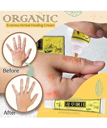 Cr me de gu rison aux herbes bio contre l'ecz ma cr me aux herbes chinoises naturelles cr me pour le visage cr me pour le corps cr me anti-d mangeaisons usage externe (12pcs) - Buy Online on GoSupps.com