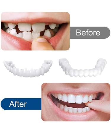 Brigtviee 2 Pairs Instant Veneer Dentures Temporary Cosmetic ClipIn Teeth Veneers Top And Bottom Click On Veneer False Teeth Confident Smile False Teeth - Buy Online on GoSupps.com