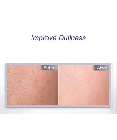 Even Skin Complexion Facial Cream - Calming Softening & Moisturizing 30g | International Shipping - Buy Online on GoSupps.com