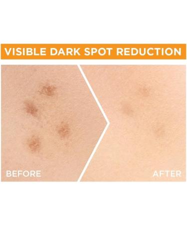 G.arnier_Skin_Naturals Bright Complete 30X Vitamin C Booster Face Serum Increases Skin's Glow Instantly and Reduces Spots Overtime with 2% Niacinamide + 0.5% Salicylic Acid for Men & Women 50 ml - Buy Online on GoSupps.com