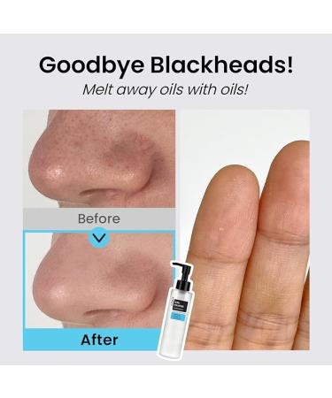 Ultra Hyaluronic Cleansing Oil - Korean Facial Cleanser for Blackhead Removal | 5.07 Fl. oz | Hydrating & Cruelty Free - Buy Online on GoSupps.com