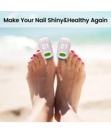 Toenail Fungus Laser Treatment Device - Effective Nail Fungal Cleaner for Onychomycosis on Fingernail & Toenail - Toe Fungus Nail Treatment - Buy Online on GoSupps.com