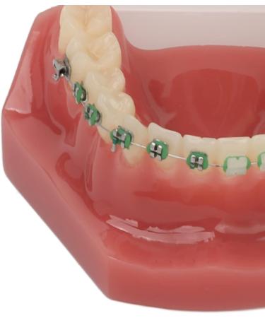Professional Portable Orthodontic Bracket Model - Ideal for Dentist Learning & Training | International Shipping Available - Buy Online on GoSupps.com