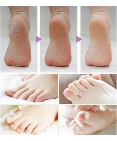 12 Pack Coarse Replacement Roller Heads for Amope Pedi Perfect Foot File - Buy Online on GoSupps.com