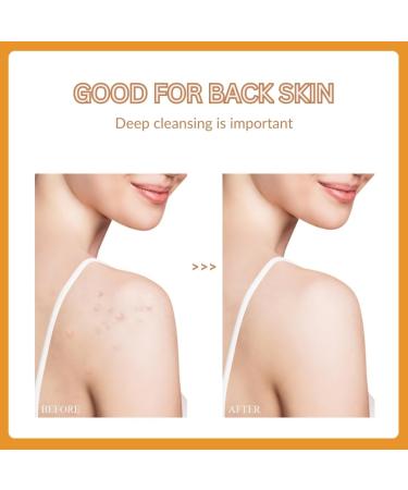 Turmeric Soap Bar with Kojic Acid - 3-in-1 Brightening & Exfoliating Soap for Face Body & Back | Natural Coconut Oil | Deep Cleansing for All Skin Types - Buy Online on GoSupps.com