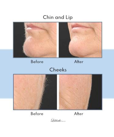 Lilibeth of New York Brow Shaper - Foldable Eyebrow Trimmer & Facial Hair Removal Tool - Peach Fuzz & Dermaplaning Device for Women - Aqua - Buy Online on GoSupps.com