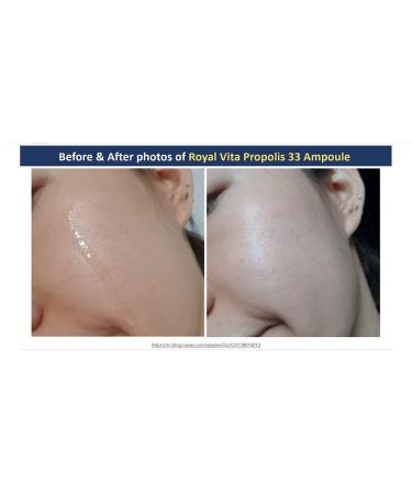 Dr.Ceuracle Royal Vita Propolis 33 Ampoule & Cream - Nourishing Skin Serum & Moisturizer | 1.01 fl.oz. & 50g | International Shipping Available - Buy Online on GoSupps.com
