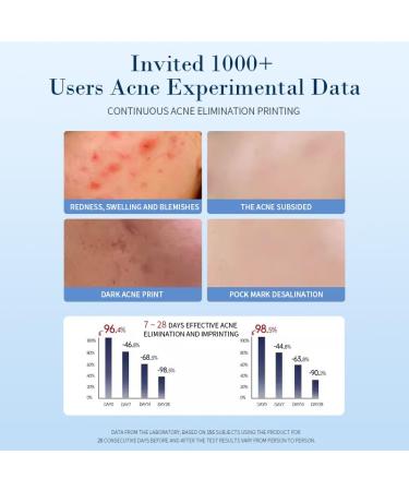 Best Acne Treatment Cream - Daily Redness Reducing Spot Treatment for Teens & Adults | Effective Pimple & Cystic Acne Care - Buy Online on GoSupps.com